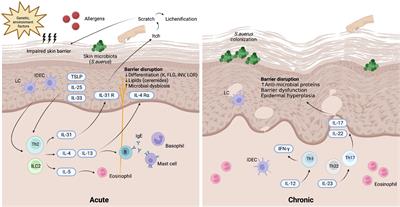JAK–STAT signaling pathway in the pathogenesis of atopic dermatitis: An updated review
